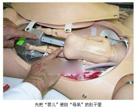 ��������ҽʦΪ����ʾģ�ͷ�����̣�ͼ��